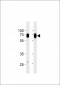 CD73(NT5E) Antibody (C-term)